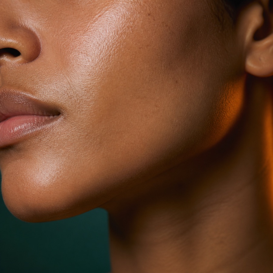 Laxity & facial support Close-up of the cheek and jawline