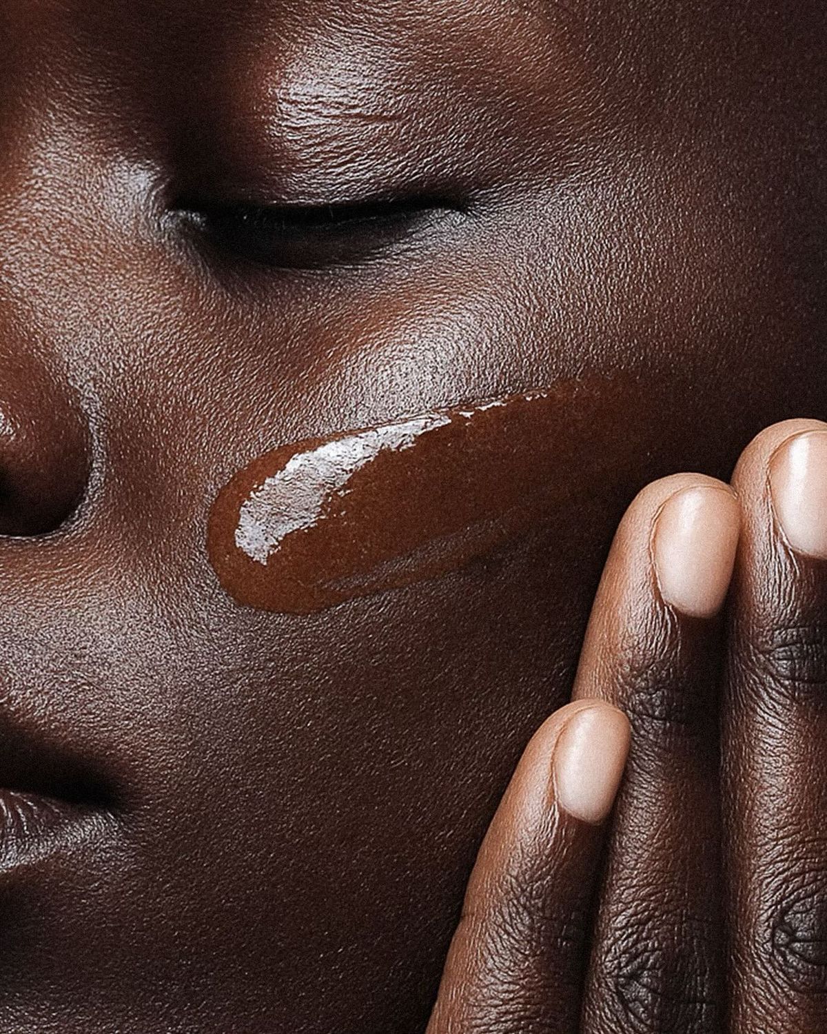 Chemical peels Close-up of serum applied to the cheek